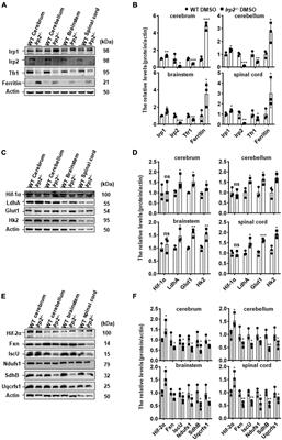 Protective Effects of Hif2 Inhibitor PT-2385 on a Neurological Disorder Induced by Deficiency of Irp2